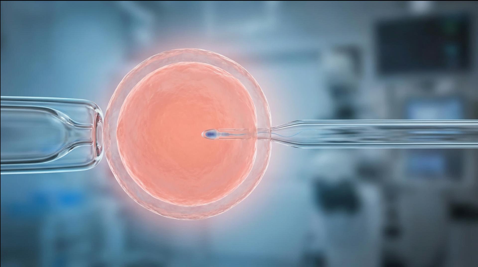 What Happens Inside the Laboratory During ICSI Technique: Detailed Explanation