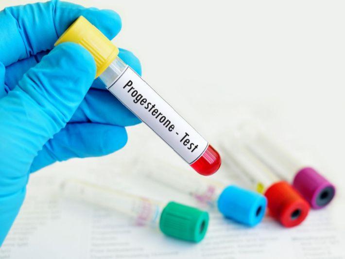 What is a Progesterone Test?