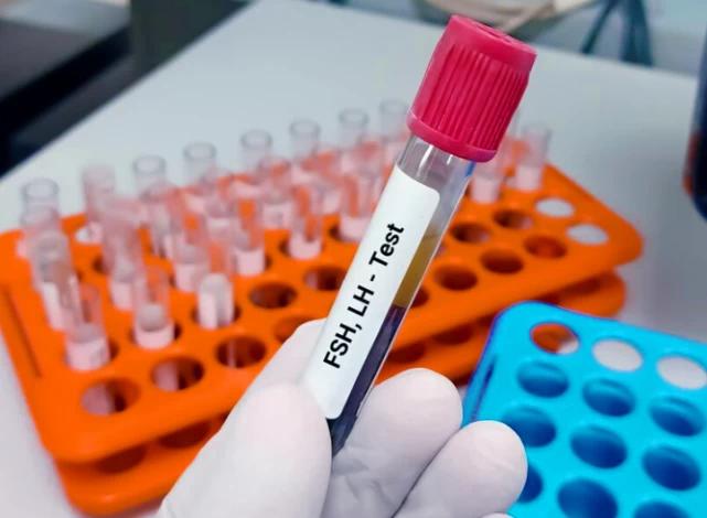 3. Gün Testi (FSH, LH ve Estradiol) Nedir?
