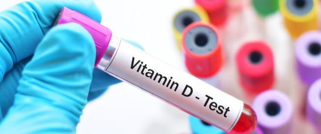 What is the Vitamin D Test and Its Impact on Fertility?