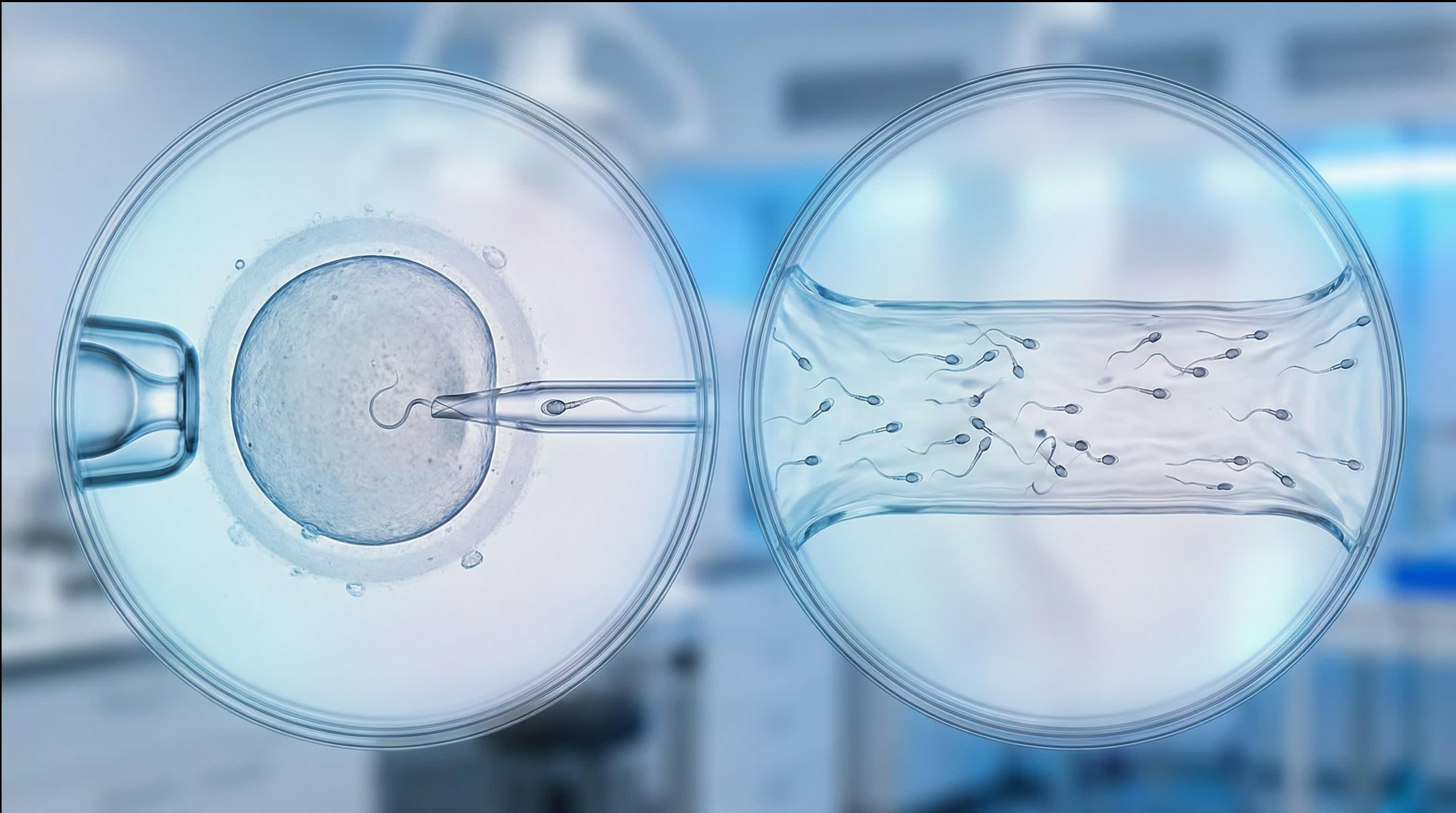 Gender Determination Techniques: What's the Difference Between ICSI and IVF?