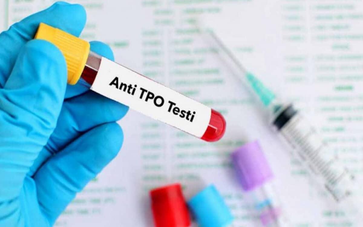 What is the Thyroid Antibodies Test and Its Impact on Fertility?