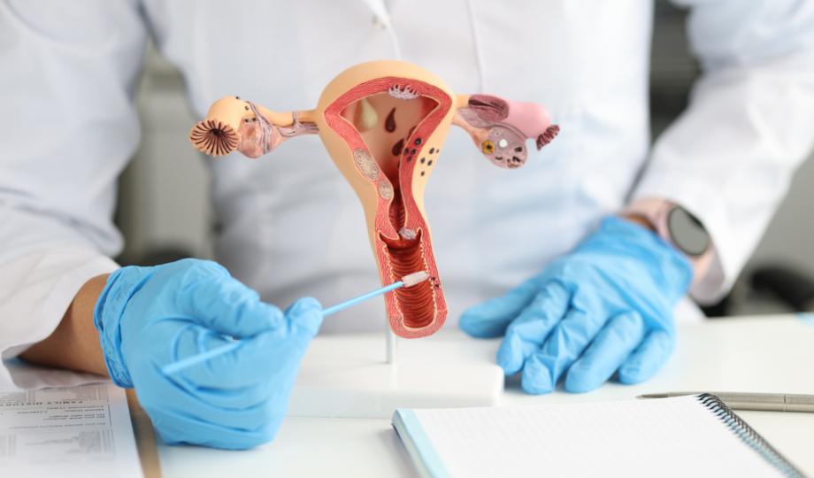What is a Pap Smear Test?