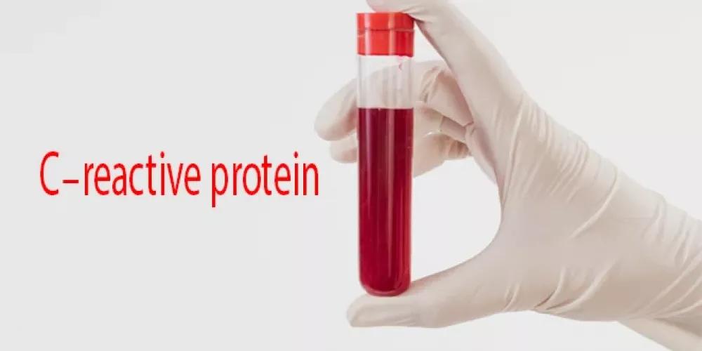 What Are the C-Reactive Protein (CRP) and ESR Tests and Their Impact on Fertility?