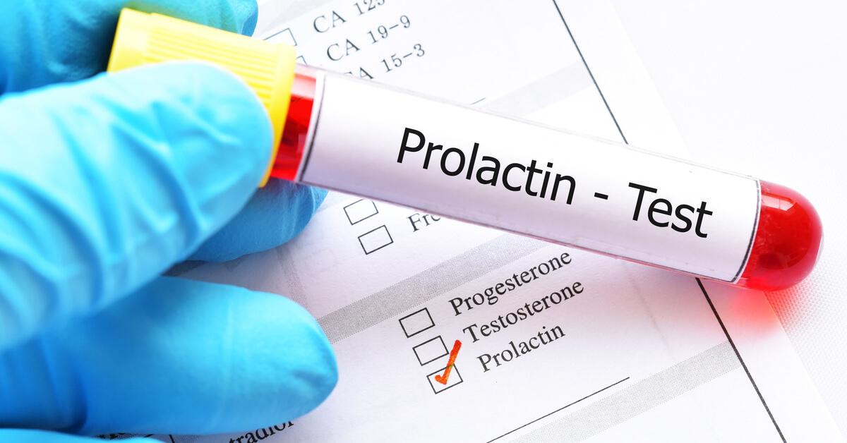 What Are the Thyroid and Prolactin Tests?