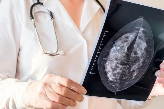 What is a Mammogram?