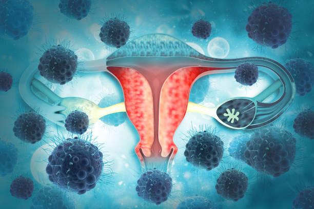 What is an Antral Follicle Count (AFC) Test?