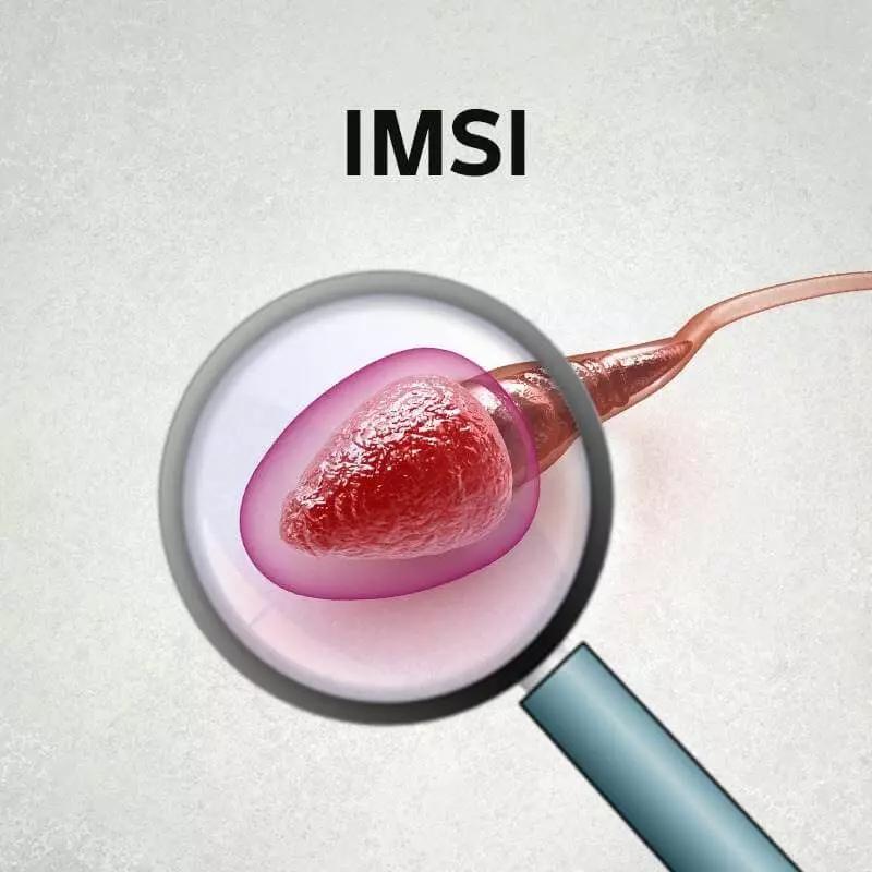 What is IMSI ?