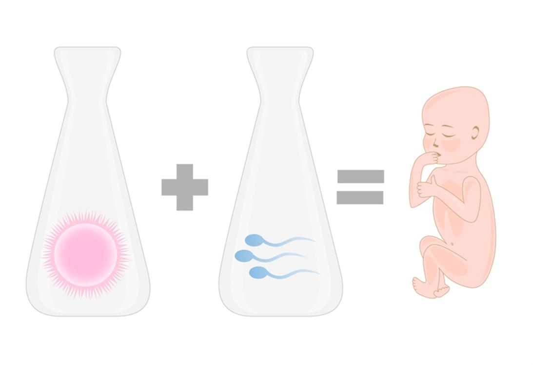 Nutrition and Its Role in Supporting the Success of In Vitro Fertilization (IVF) Process