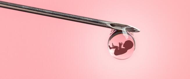 In Vitro Fertilization: Definition and Steps